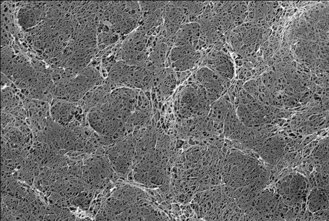 Scanning electron micrograph of an ARACHNE separator surface showing a dense, interconnected aramid nanofiber mesh